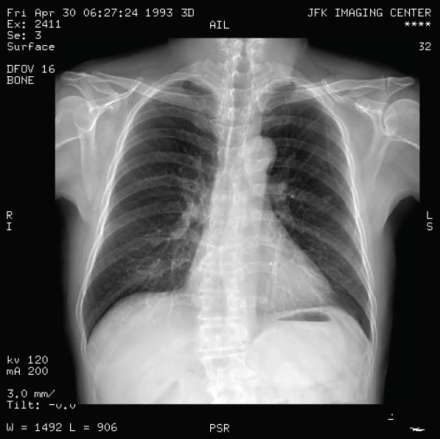 Dicom Visualization | Drupal.org